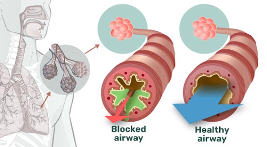 How Airphysio Works