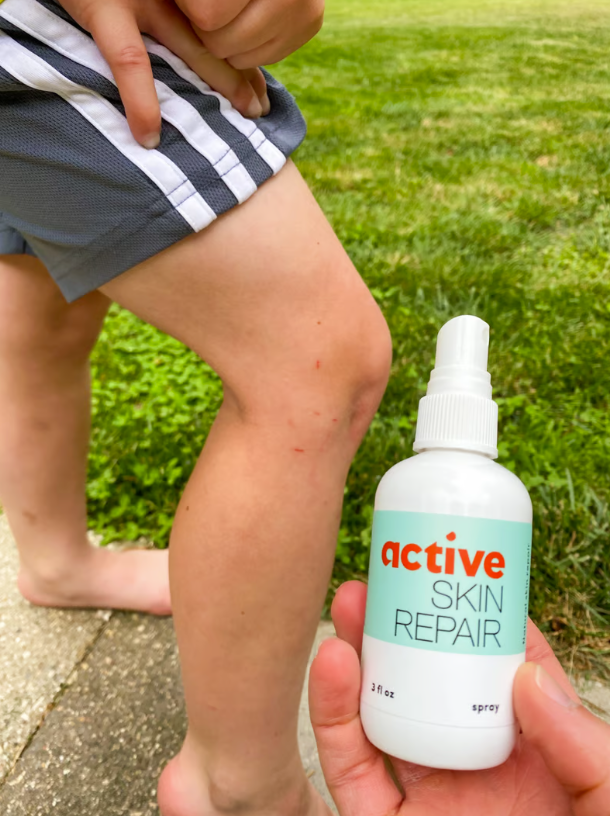 Active Skin Repair Features