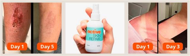 How to Use Active Skin Repair